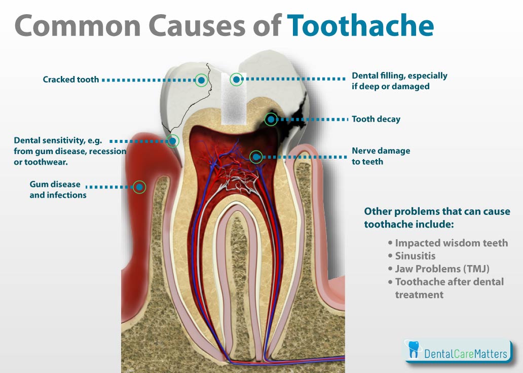 how to get rid of toothache in the middle of the night